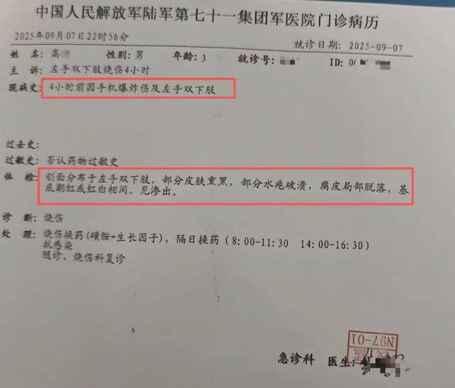 3岁男童看视频时手机突然爆炸，手指下肢被烧伤，涉事机型小米13上市不足3年，客服回应
